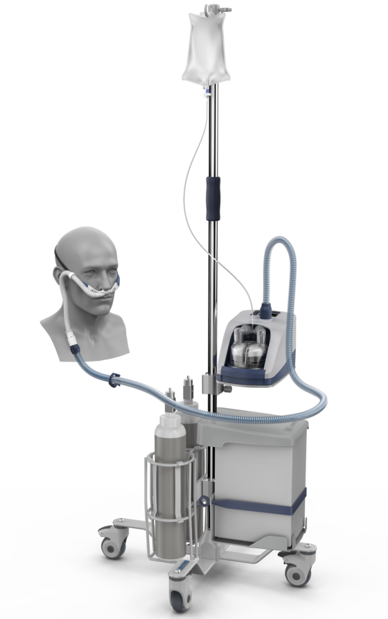 Tubuladura Optiflow AirSpiral