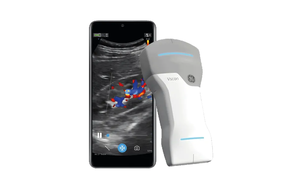 Vscan Air™ CL